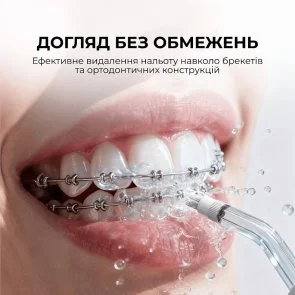Фото: Іригатор DEERMA DEM-CY01 № 5 | KTC