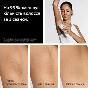 Фото: Епілятор Braun Silk-expert Pro 5 IPL PL 5412 (PL5412) № 4 | KTC