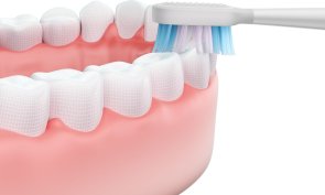 Електрична зубна щітка Xiaomi Smart Electric Toothbrush T501 (1035681)