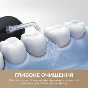 Іригатор Mova Ripple 10 (AWF14A-BK)