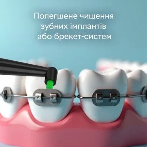 Фото: Насадка для зубної щітки PECHAM Mono-bundle medium stiffness Black (4820201379622.0) № 6 | KTC