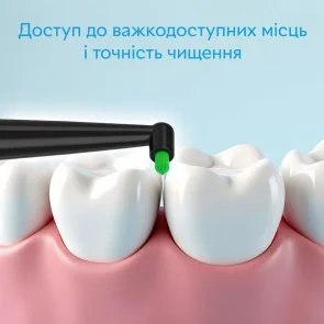 Фото: Насадка для зубної щітки PECHAM Mono-bundle medium stiffness Black (4820201379622.0) № 5 | KTC