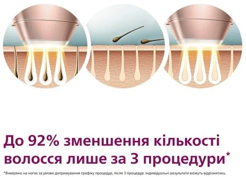 Фото: Епілятор Philips Lumea IPL 9900 Series (BRI973/00) № 27 | KTC