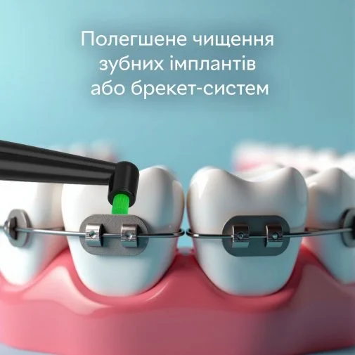 Фото: Насадка для зубної щітки PECHAM Mono-bundle medium stiffness Black (4820201379622.0) № 12 | KTC